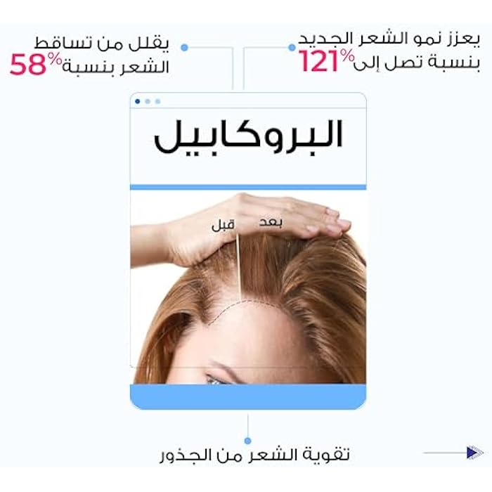 Twist & Go Anti Hair Loss Lotion 250ml + Twist & Go Condensed Anti-Hair Loss Lotion 100ml | Hair Growth | Nourishes hair | hair growth | Capixil and Procapil |moisturizes hair | Alcohol Free - Image 4